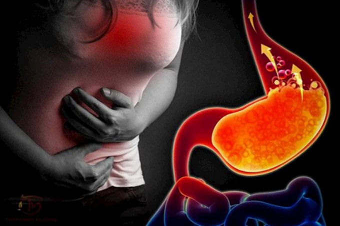 Bí quyết duy trì nồng độ axit trong dạ dày ổn định