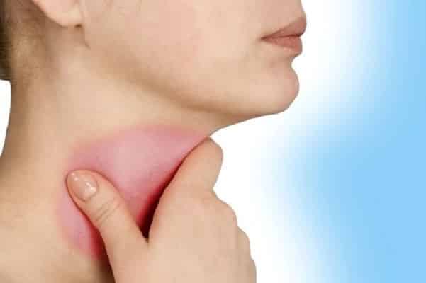 Nguyên nhân, triệu chứng, cách điều trị và phòng ngừa viêm họng liên cầu khuẩn