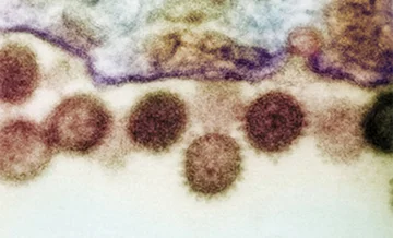 Loại virus gây tử vong lên tới 40% xuất hiện tại Anh