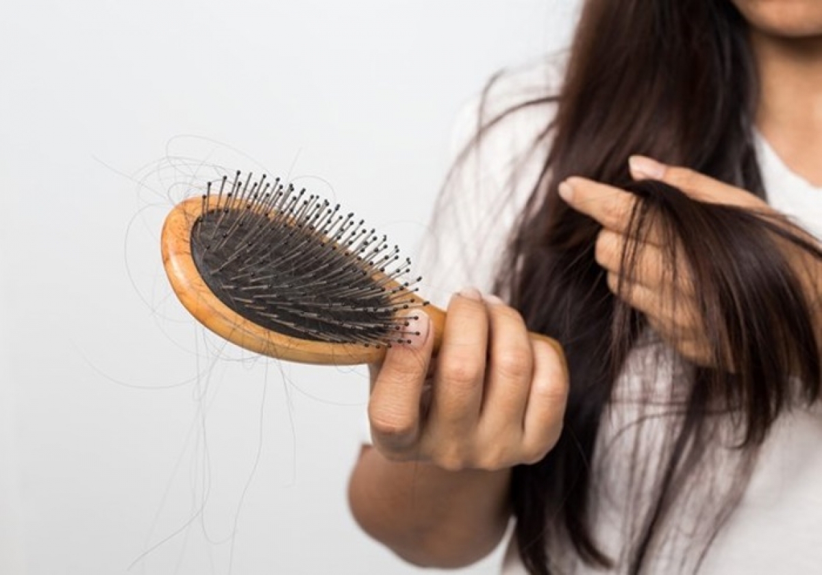 Rụng hơn 100 sợi tóc một ngày cảnh báo bệnh