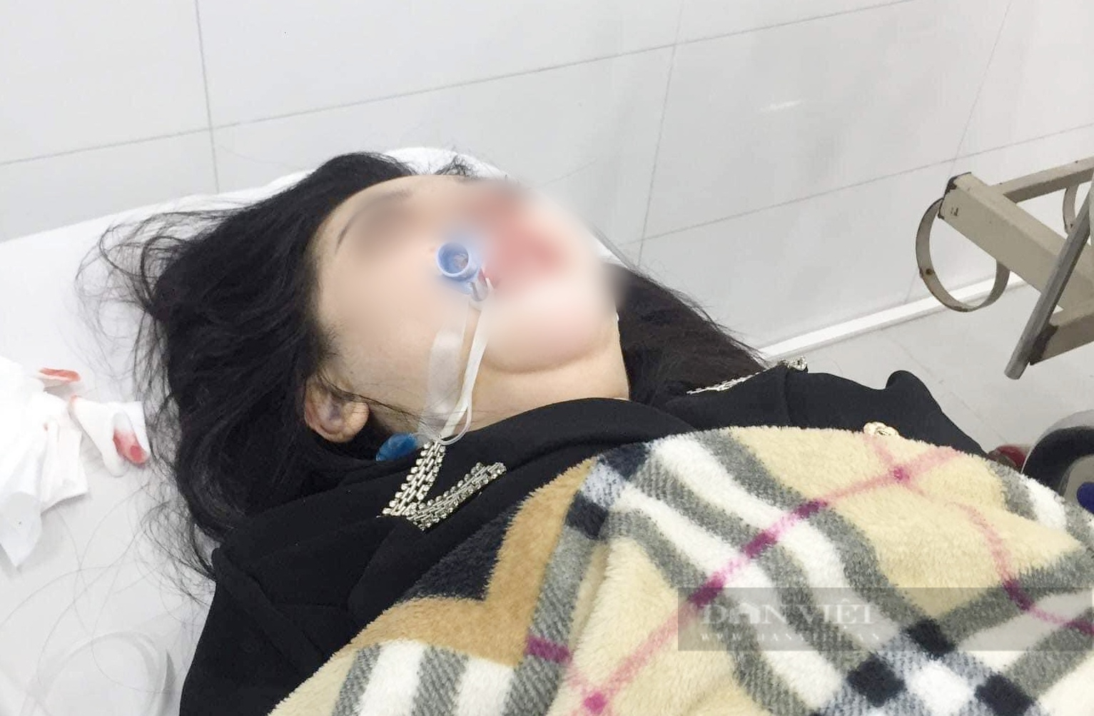 Vụ cô gái 22 tuổi tử vong vì nâng mũi: Những biến chứng nguy hiểm khi phẫu thuật nâng mũi