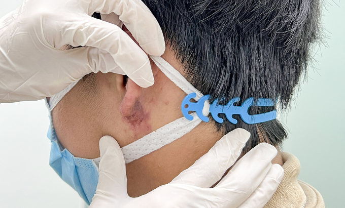 Sửa thành ‘tai Phật’ – nhiều rủi ro hơn ước mong đổi vận