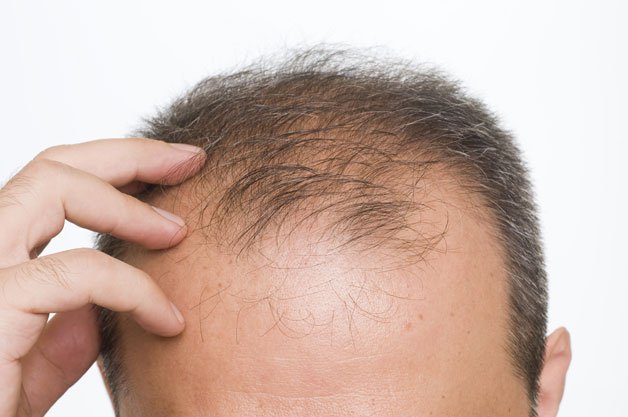 Triệu chứng báo hiệu thiếu hụt nội tiết tố androgen ở nam giới