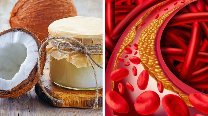 11 loại thực phẩm phổ biến có thể không tốt cho sức khỏe