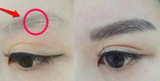 Lông mày thưa dần có thể là dấu hiệu bệnh tật
