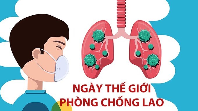 Ngày Thế giới Phòng chống lao 24/3/2023: Chúng ta có thể chấm dứt bệnh lao