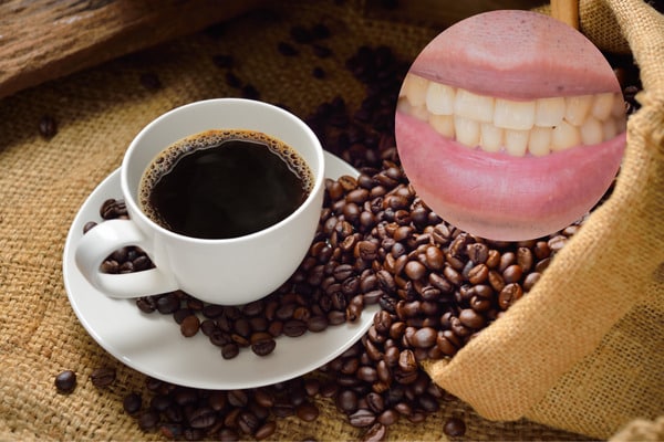 Giải pháp ngăn ngừa khả năng gây hại của cà phê đối với răng miệng