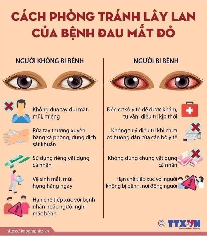 Bệnh đau mắt đỏ gia tăng, Bộ Y tế chỉ cách phòng bệnh