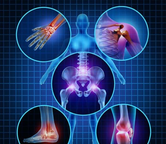 Phòng tránh bệnh xương khớp tái phát