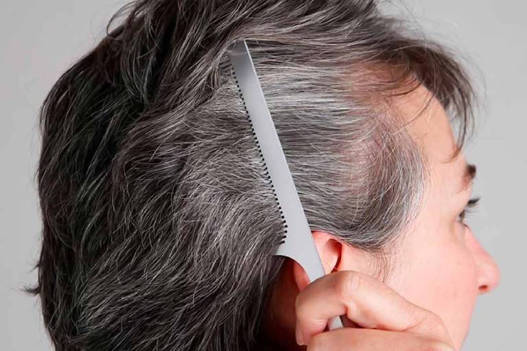 6 bí quyết ngăn ngừa rụng tóc ở người cao tuổi