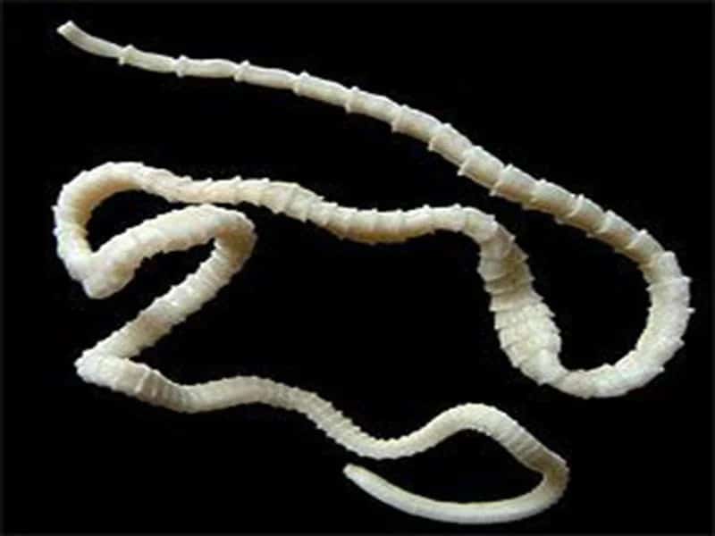 Với thói quen ăn gỏi cá, tiết canh và nem sống, người đàn ông có sán dây 10 m trong bụng