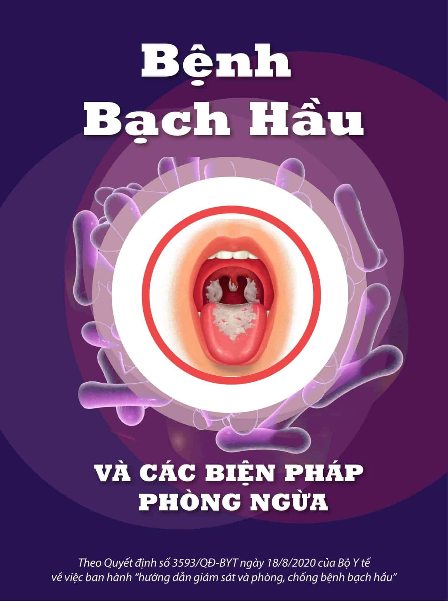 Infographics: Bệnh bạch hầu và các biện pháp phòng ngừa