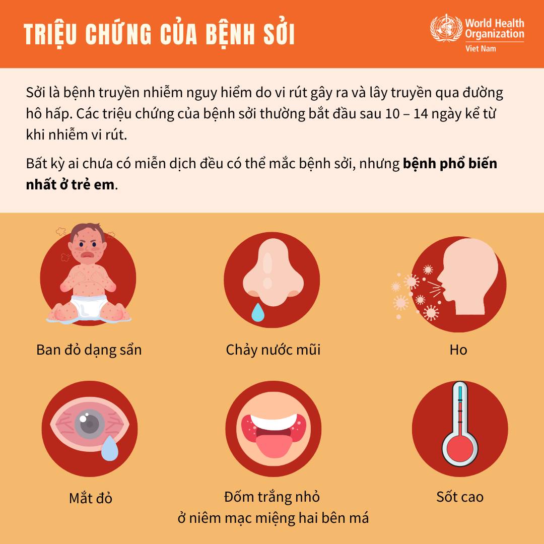 Inforgraphic: Triệu chứng và cách phòng ngừa bệnh sởi