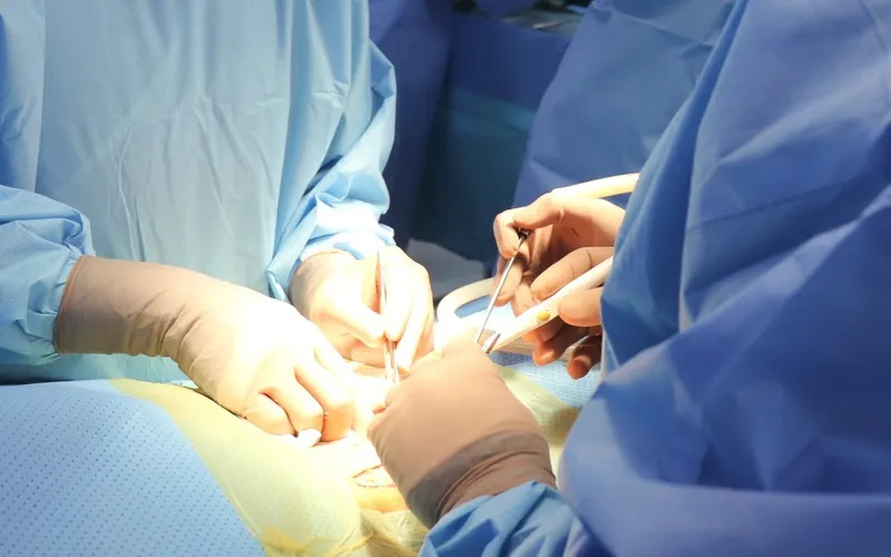 TP. Hồ Chí Minh: Điều trị cho bé trai 4 tuổi bị táo bón kéo dài