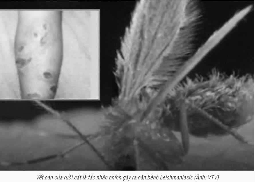 Thái Lan: Cảnh báo bệnh nhiễm ký sinh trùng Leishmania gây tử vong