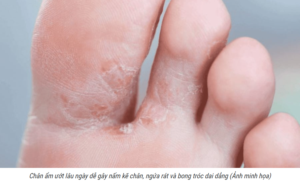 Nguy hiểm tiềm ẩn từ đôi chân ướt trong mùa mưa