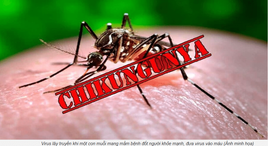 Nguy cơ bùng phát bệnh lan rộng toàn cầu do virus chikungunya