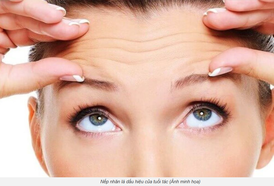 Vì sao nếp nhăn trên trán xuất hiện khi bạn còn trẻ?