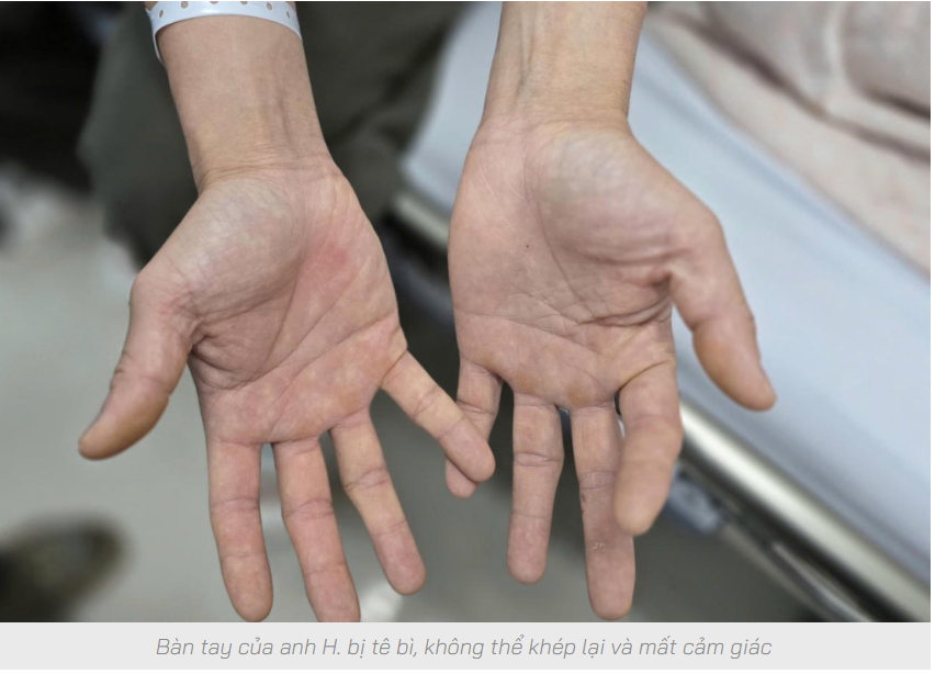 Chơi bóng cười đến liệt người – Lời cảnh tỉnh cho giới trẻ