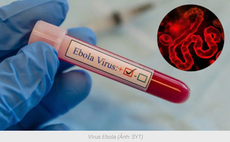 Tăng cường giám sát cửa khẩu, chủ động chặn nguy cơ Ebola xâm nhập
